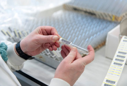 Vacancy: NRS Hepatology Clinical Lead